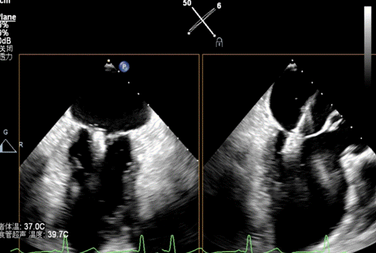 截屏2023-03-13 08.52.11