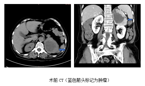 1687762963163.png 1687762963163.png