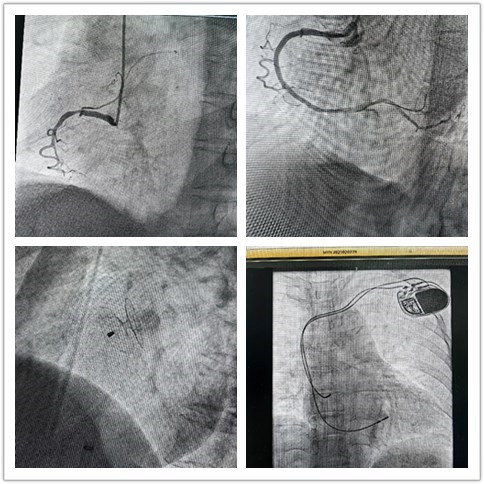 initpintu_副本 initpintu_副本